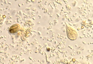 Giardia parasite stool - daliaudvar.hu